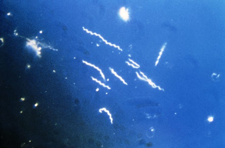 Borrelia burgdorferi lyme