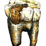 Hominindentalfossil148