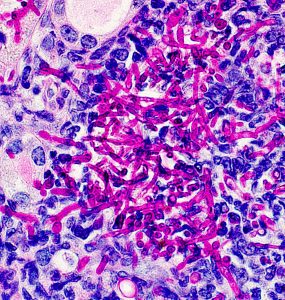 Candidaalbicansintissue